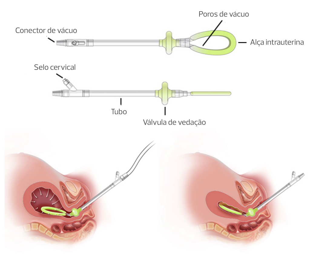 Sistema Jada