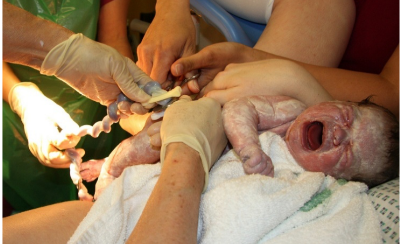 Cortando cordão umbilical