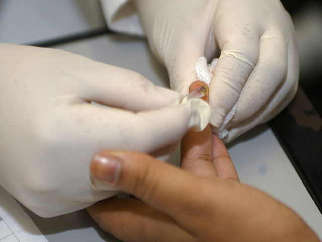 Fotografia em que aparece as mãos de um profissional da saúde realizando exame de coleta de sangue por lanceta em punção de dedo anelar de uma outra pessoa.