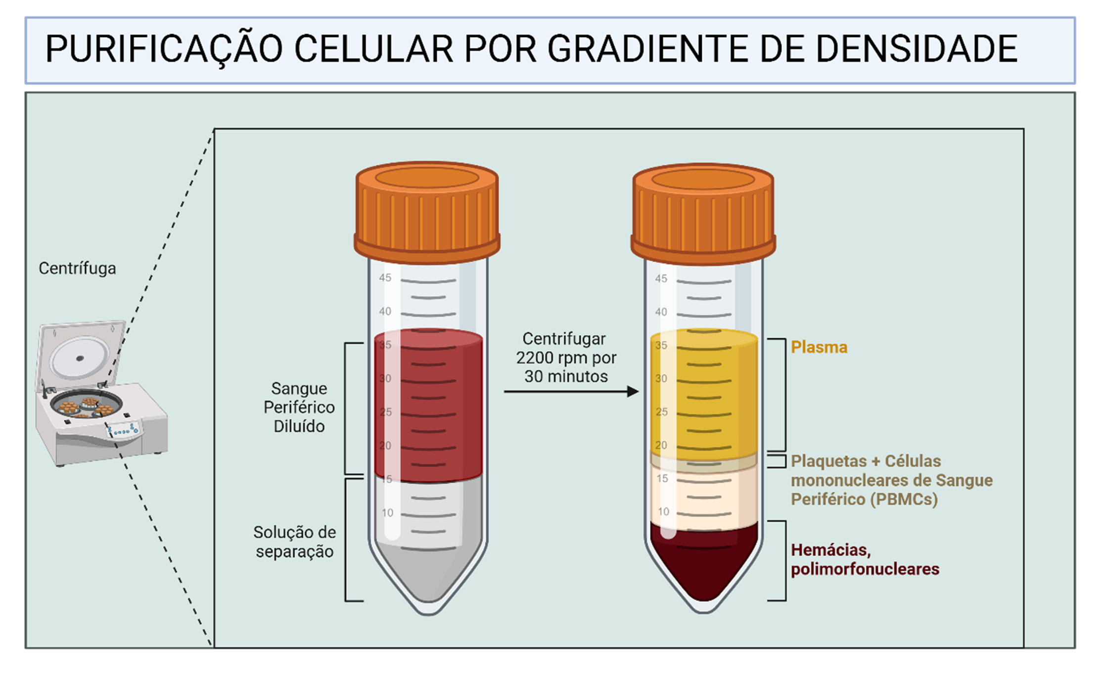 Purificação celular por gradiente de densidade, separando plasma, PBMCs, plaquetas, hemácias e polimorfonucleares via centrifugação. 
