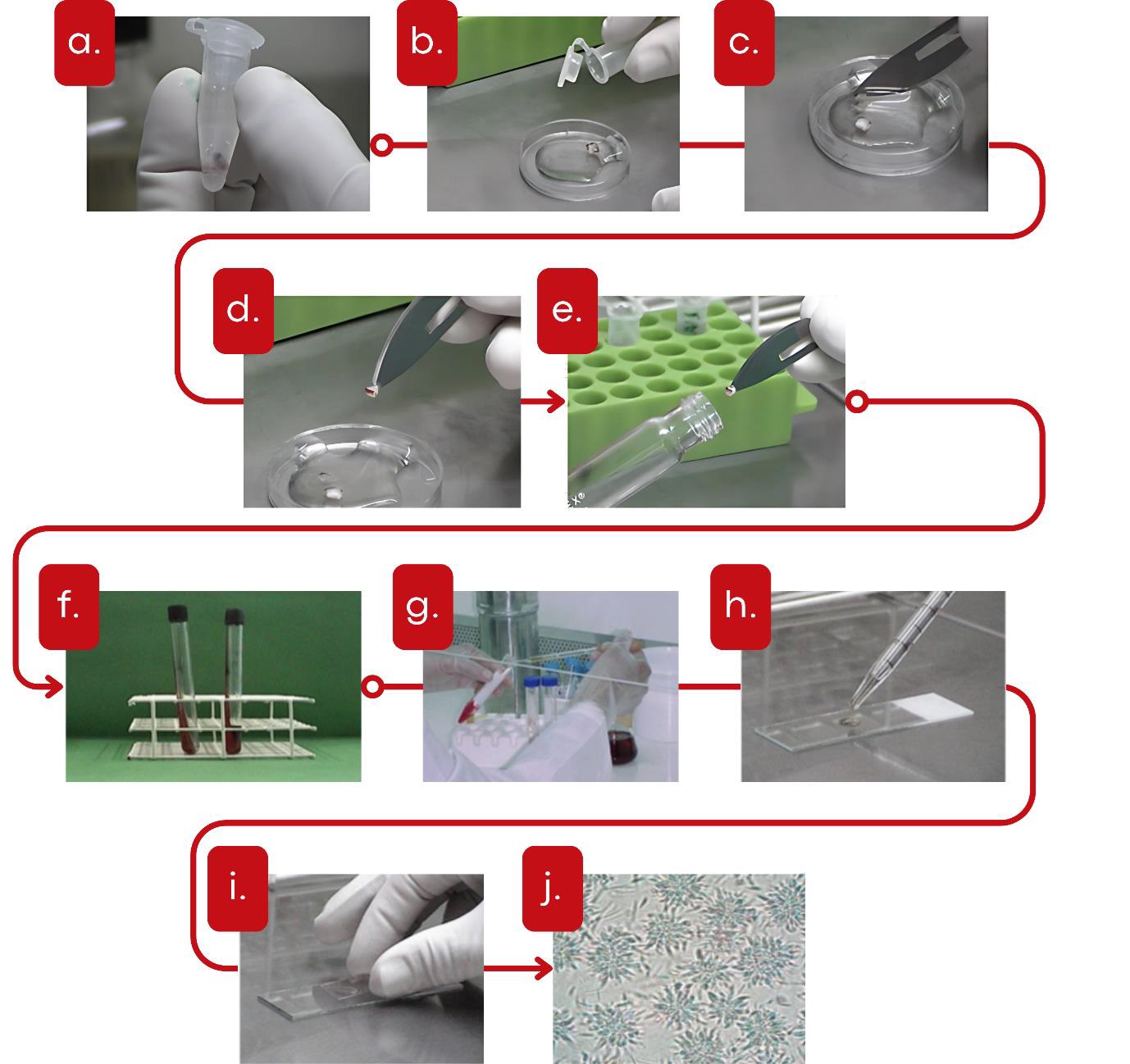 Sequência ilustrada do método indireto para isolamento de Leishmania, mostrando as etapas laboratoriais do procedimento. (a) Amostra biológica armazenada em tubo de microcentrífuga sendo segurado com luva. (b) Transferência da amostra para placa de Petri. (c) Fragmentação do material biológico com bisturi dentro da placa. (d) Pinça segurando o fragmento biológico. (e) Transferência do fragmento para tubo de cultura posicionado em suporte. (f) Dois tubos de cultura com meio de cultivo em estante de plástico. (g) Processamento adicional do material com pipetas e tubos na capela. (h) Gotejamento do material biológico sobre lâmina de vidro. (i) Fixação da amostra na lâmina com outra lâmina sendo pressionada. (j) Imagem microscópica de formas parasitárias de Leishmania em campo de visão. Fonte: Figura 24. Demonstração prática do método indireto para isolamento de Leishmania.​