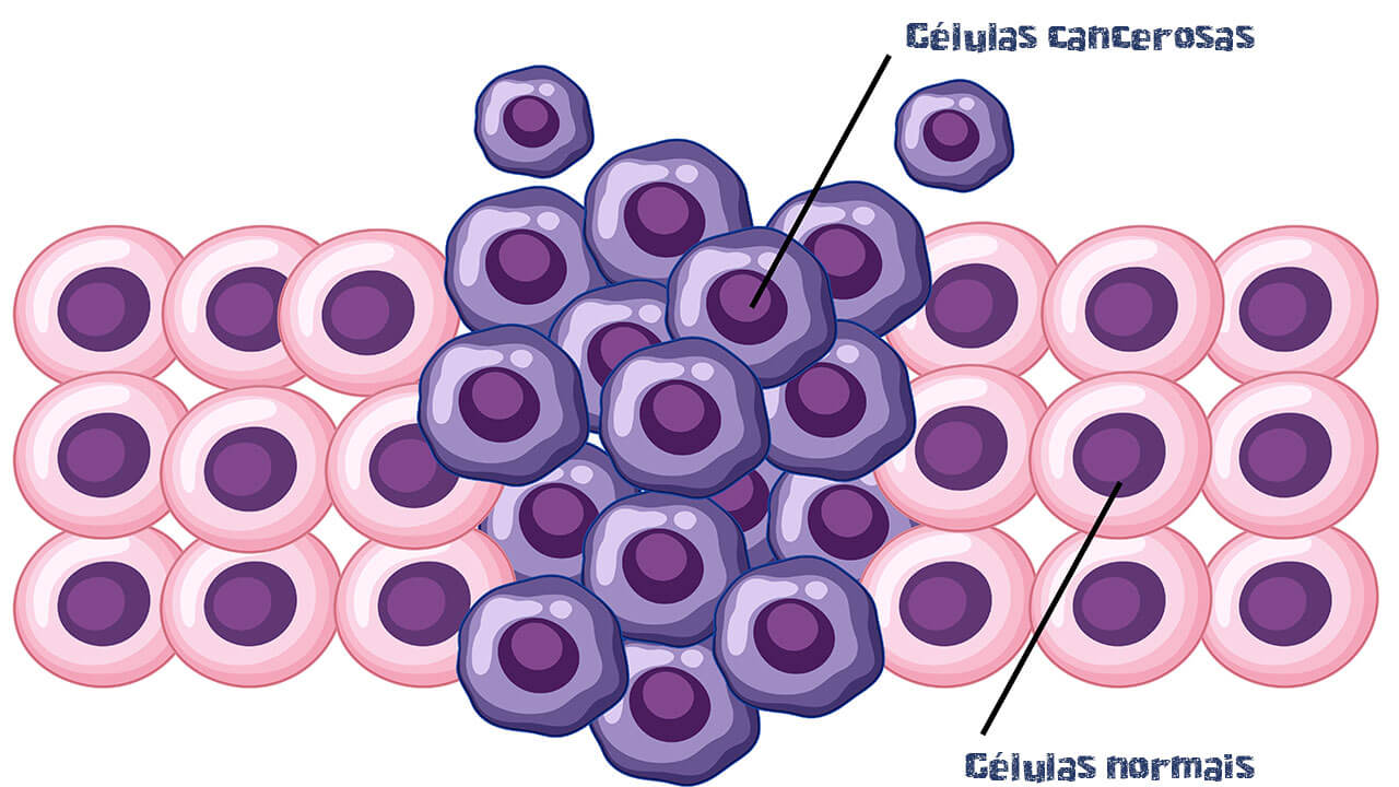 Figura ilustrativa de células normais e cancerosas, as células normais são ordenadas, escuras no centro e mais claras ao redor, já as células cancerosas são completamente escuras e desordenadas.