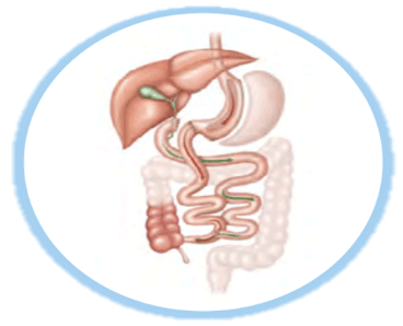 Duodenal switch, além de transformar o estômago em um tubo, o cirurgião faz aquele desvio do intestino para aumentar a produção de hormônios da saciedade.