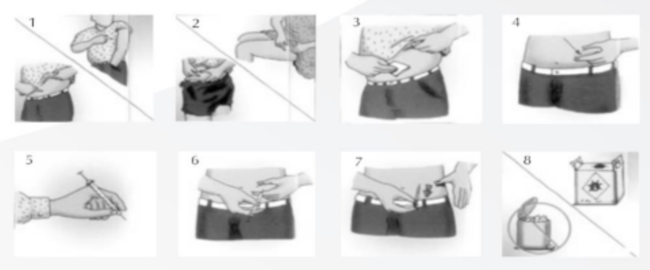 Orientações para aplicação adequada da insulina, primeiro você escolhe a parte do corpo para a aplicação conforme o desenho, depois limpe a pele com água e sabão ou algodão e álcool, segure com as pontas dos dedos uma área da pele e faça uma prega cutânea, pegue a seringa e segure-a como se fosse um lápis, introduza a agulha na pele num ângulo de 90 graus, solte a prega cutânea e injete toda a insulina da seringa, retire a agulha, pressione o local da aplicação por alguns segundos.