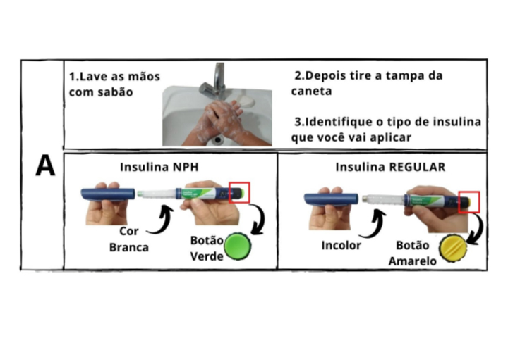 Como aplicar Insulina nas apresentações caneta, primeiro lave as mãos com sabão, depois tire a tampa da caneta, o terceiro passo é identificar o tipo de insulina que você vai aplicar, a insulina NPH fica na cor branca e o botão na parte traseira verde, a insulina regular, fica incolor e com o botão amarelo.