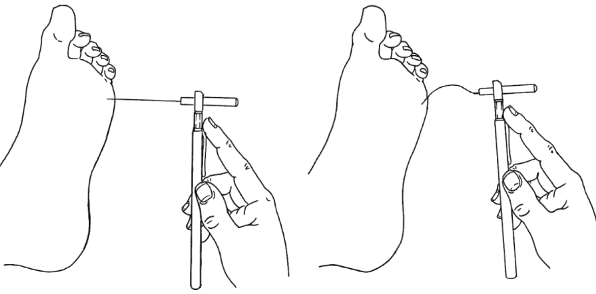 Fonte: Manual do Pé Diabético