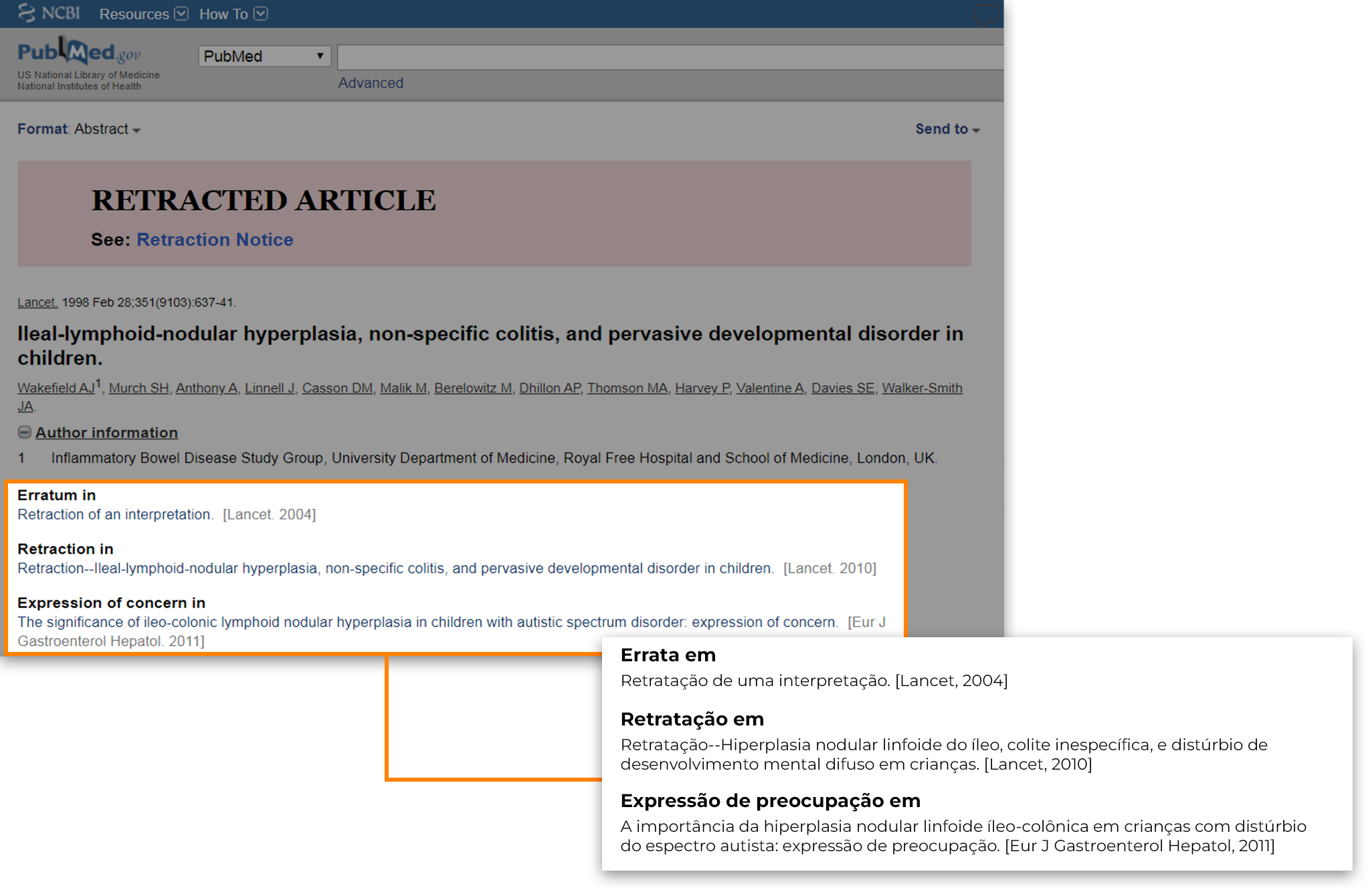 Captura de tela de uma retratação de artigo, com a errata em retratação de uma interpretação [Lancet, 2004]. Retratação em Hiperplasia nodular linfoide do íleo, colite inespecífica, e distúrbio de desenvolvimento mental difuso em crianças. [Lancet, 2010]. Expressão de preocupação em a importância da hiperplasia nodular linfoide íleo-colônica em crianças com distúrbio do espectro autista: expressão de preocupação. [Eur J Gastroenterol Hepatol, 2011].