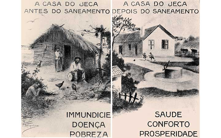 A casa do Jeca antes e depois do saneamento. Monteiro Lobato, entusiasta da campanha sanitarista, expressou com seu Jeca Tatu, portador de ancilostomíase, a imagem dos sertanejos doentes e das perspectivas de sua “redenção” mediante a melhoria de suas condições de saúde.