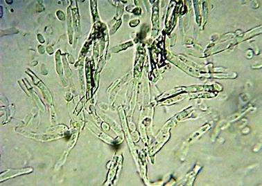 Penicilina (Penicillium)