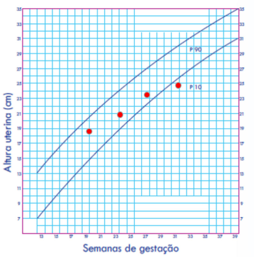 Gráfico